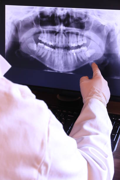 Best Emergency TMJ Treatment in Hanford, CA
