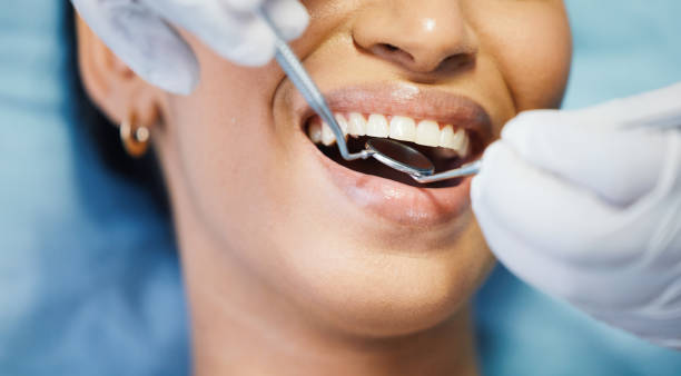 Best Emergency Wisdom Teeth Removal in Hanford, CA